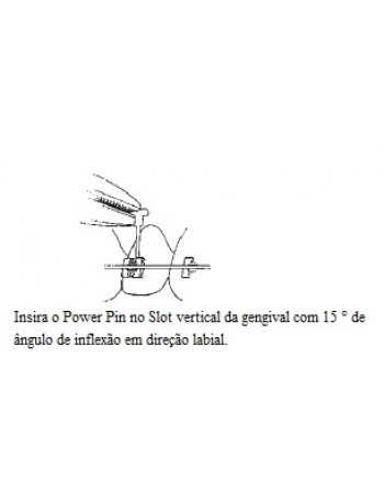 Power Pin - Pino para braquete com slot vertical - 50 unid.